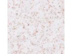 Terralith Buntsteinputz Mosaikputz 1mm -15 kg- BSP1099 Weiss Braun