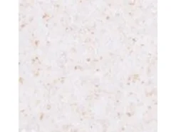 Terralith Buntsteinputz Mosaikputz 1mm -15 kg- BSP1078 Weiss Gold